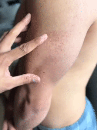 Loción corporal con nicotinamida, Ayuda a eliminar granitos en brazos y piernas - con 50% de descuento